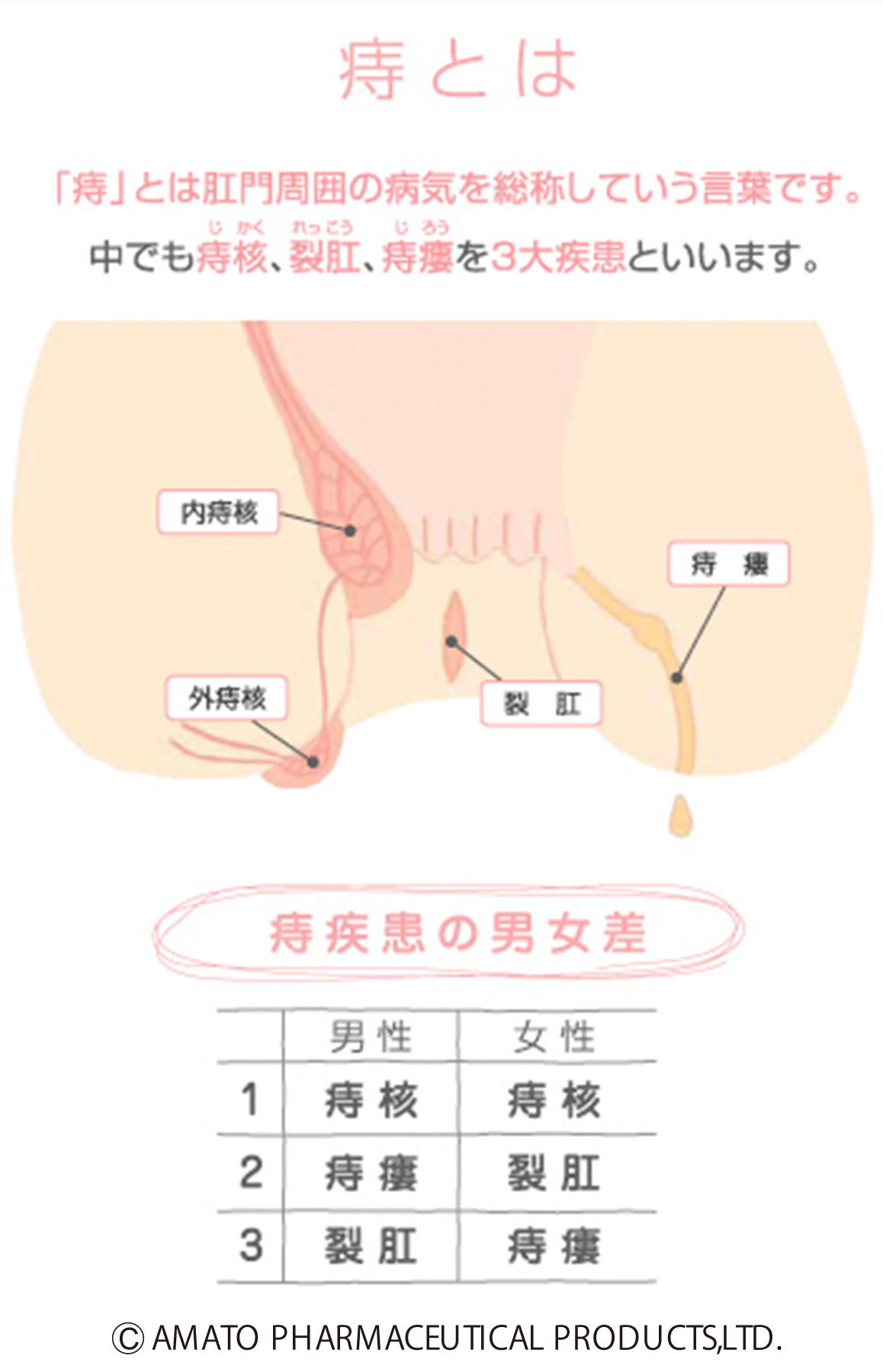 腸液 痛い